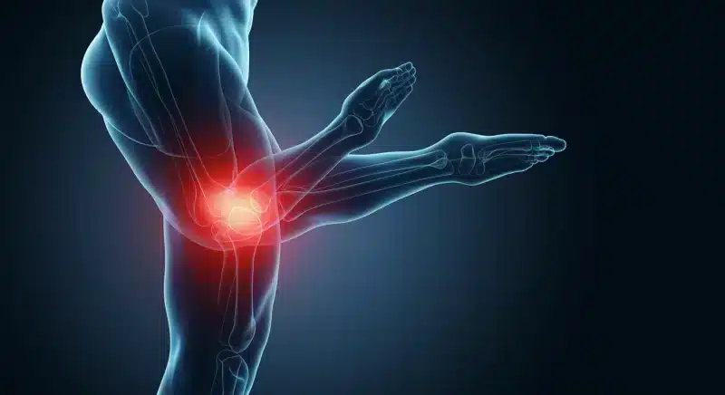 Bong gân là gì? Nguyên nhân, triệu chứng và cách điều trị
