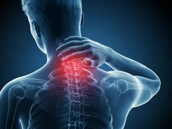Đau cổ vai gáy: Triệu chứng, nguyên nhân và cách điều tri