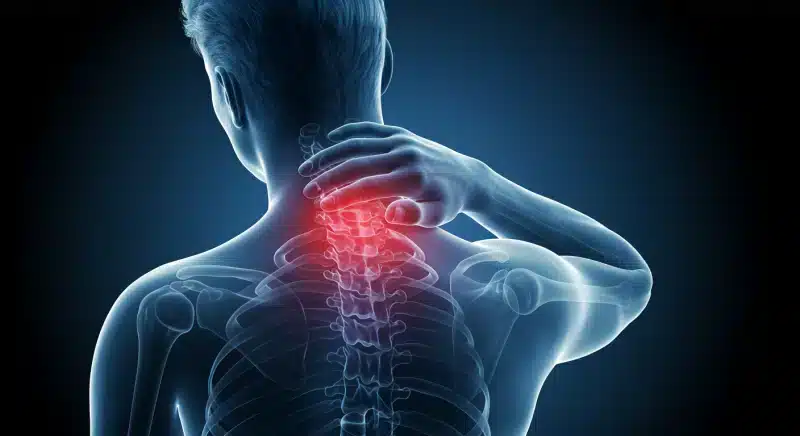 Đau cổ vai gáy: Triệu chứng, nguyên nhân và cách điều tri