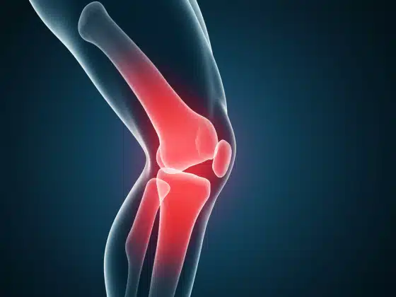 Đau đầu gối: Triệu chứng, nguyên nhân, chẩn đoán và điều trị