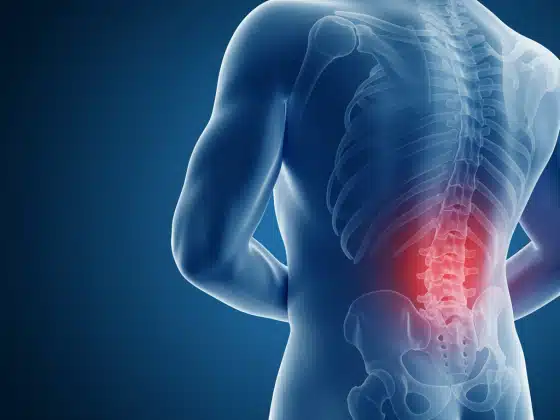 Đau thắt lưng: Triệu chứng, chẩn đoán và cách điều trị