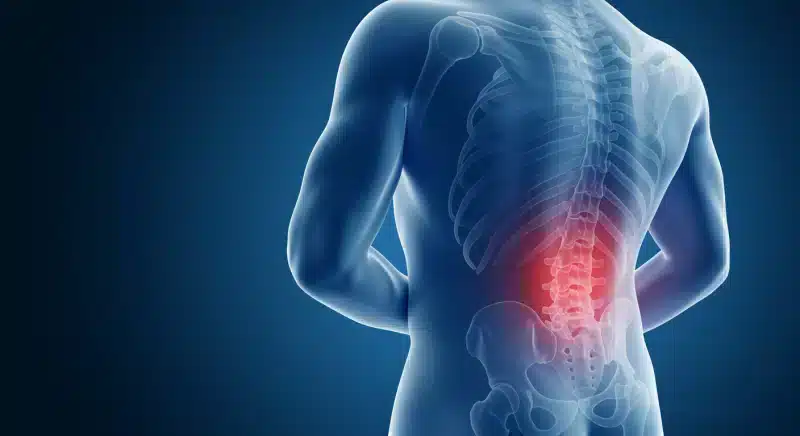Đau thắt lưng: Triệu chứng, chẩn đoán và cách điều trị