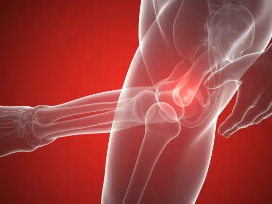 Đau xương khớp: Triệu chứng, nguyên nhân và cách điều trị