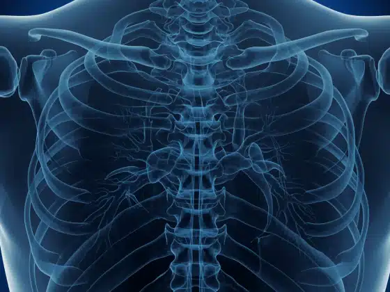 Gai cột sống: Triệu chứng, nguyên nhân và cách điều trị