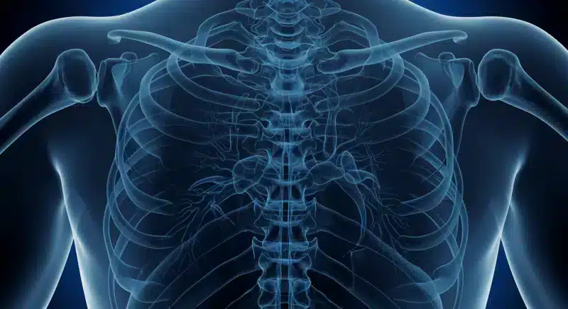 Gai cột sống: Triệu chứng, nguyên nhân và cách điều trị