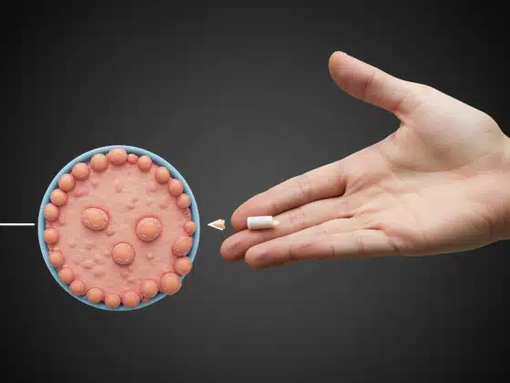 Gai đen là gì? Triệu chứng và cách điều trị gai đen