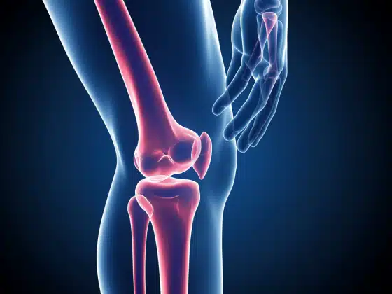 Gai khớp gối: Triệu chứng, nguyên nhân và điều trị