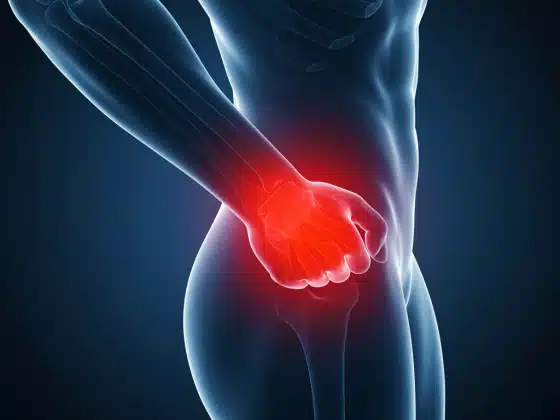 Giãn dây chằng: Triệu chứng, nguyên nhân và cách điều trị