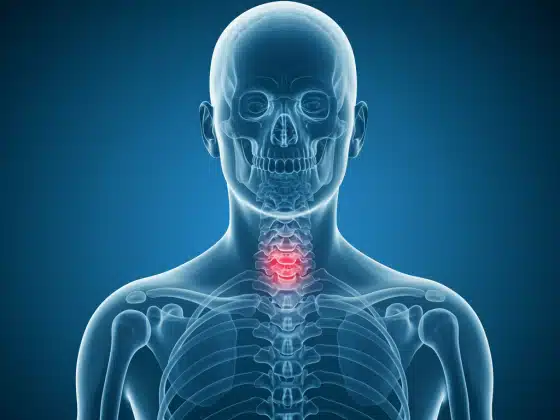 Hẹp lỗ liên hợp đốt sống cổ là gì? Nguyên nhân, triệu chứng và cách điều trị