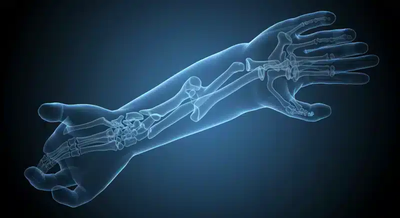 Loạn dưỡng xương là gì? Nguyên nhân, triệu chứng và cách điều trị