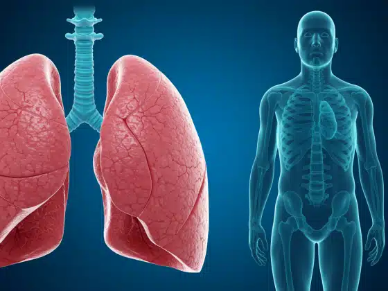 Phổi Kẽ: Nguyên Nhân, Triệu Chứng Và Điều Trị Chi Tiết