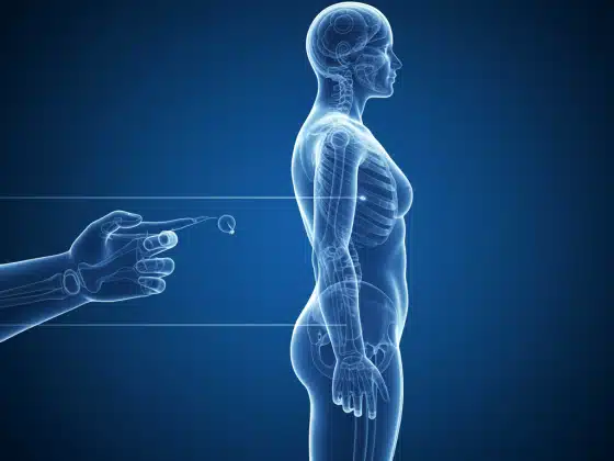 Rạn xương: Nguyên nhân, triệu chứng và biện pháp phòng ngừa