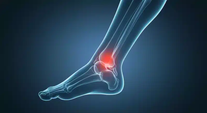 Sưng khớp là gì? Nguyên nhân và cách điều trị sưng khớp