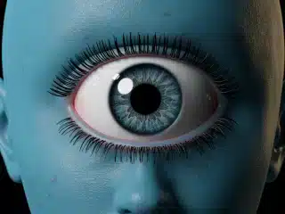 Tật Không Nhãn Cầu: Hiểu Rõ Nguyên Nhân và Cách Chăm Sóc