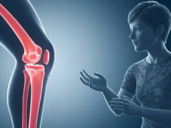 Thoái hóa khớp gối là gì? Triệu chứng, nguyên nhân và điều trị