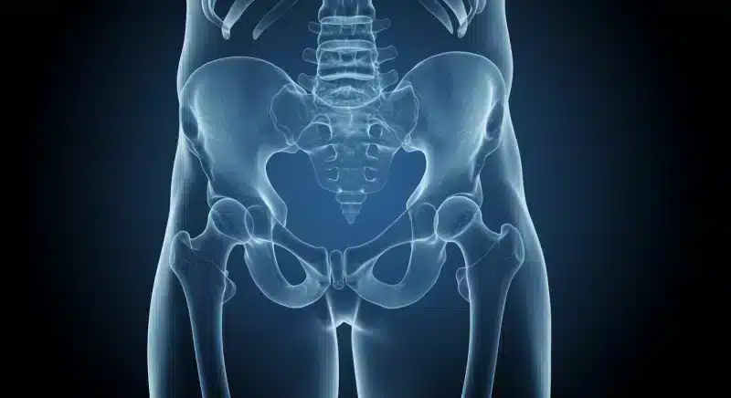 Thoái hóa khớp háng: Triệu chứng, nguyên nhân và điều trị