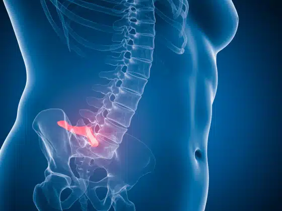 Thoát vị đĩa đệm là gì? Triệu chứng, nguyên nhân và cách điều trị