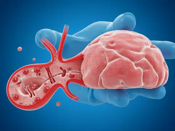 U tụy nội tiết Insulinoma là gì? Nguyên nhân, triệu chứng và cách điều trị