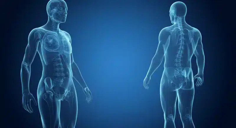 Vẹo cột sống: Triệu chứng, nguyên nhân, chẩn đoán và điều trị