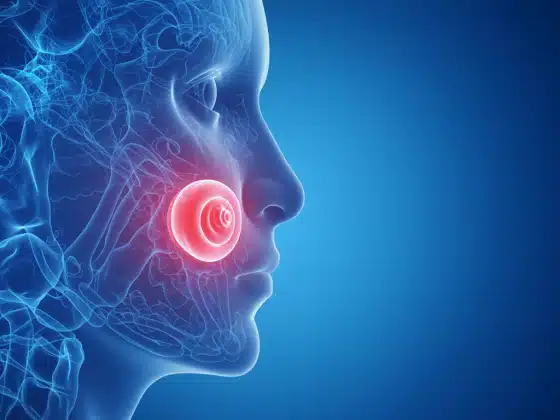 Viêm bao hoạt dịch: Triệu chứng, nguyên nhân, chẩn đoán và điều trị