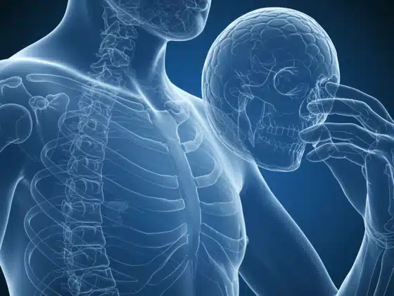 Viêm đa cơ: Triệu chứng, nguyên nhân và cách điều trị