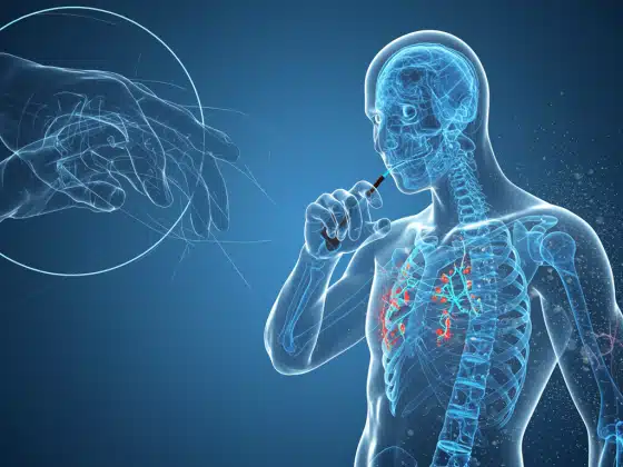 Viêm đa khớp: Nguyên nhân, triệu chứng và cách điều trị
