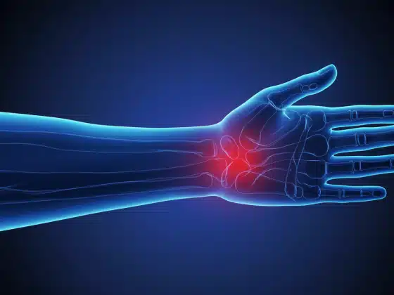 Viêm gân: Triệu chứng, nguyên nhân và cách điều trị