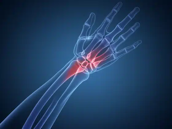 Viêm khớp cổ tay: Triệu chứng, nguyên nhân và cách điều trị