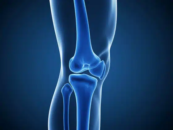 Viêm khớp gối: Triệu chứng, nguyên nhân và cách điều trị