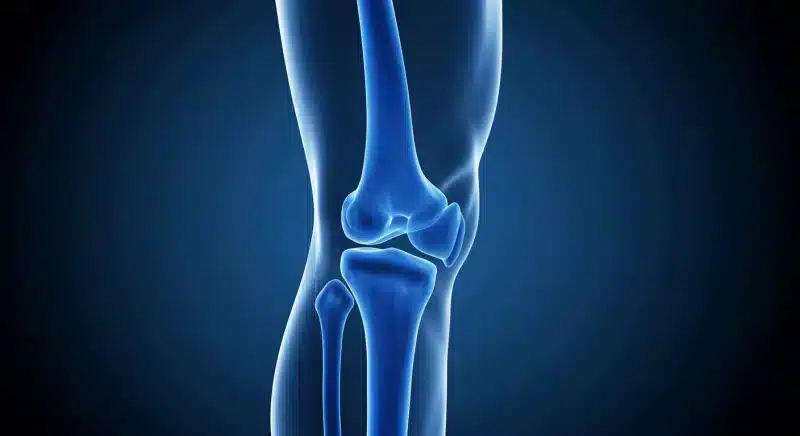Viêm khớp gối: Triệu chứng, nguyên nhân và cách điều trị