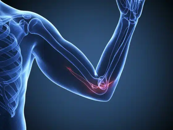 Viêm khớp khuỷu tay: Triệu chứng, nguyên nhân và cách điều trị
