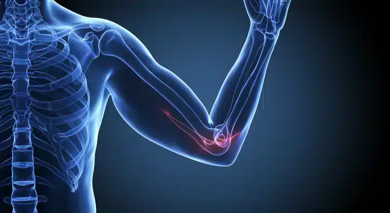 Viêm khớp khuỷu tay: Triệu chứng, nguyên nhân và cách điều trị