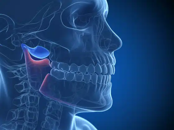 Viêm khớp thái dương hàm: Triệu chứng, nguyên nhân, chẩn đoán và điều trị