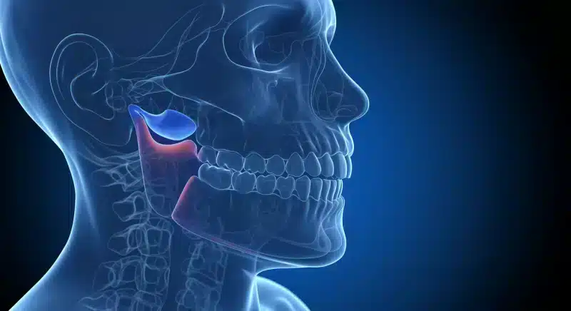 Viêm khớp thái dương hàm: Triệu chứng, nguyên nhân, chẩn đoán và điều trị