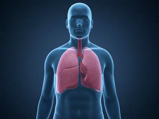 Viêm Phổi Mãn Tính: Hiểu Đúng Để Chủ Động Bảo Vệ Sức Khỏe