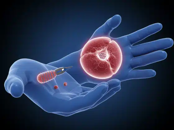 Vôi hóa sụn khớp là gì? Nguyên nhân và cách điều trị.